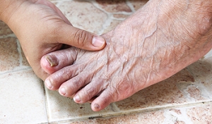 Toenail Fungus in the Elderly Population